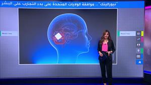 نيورالينك - تقنية تستخدم شريحة المخ تدخل مرحلة التجارب على البشر